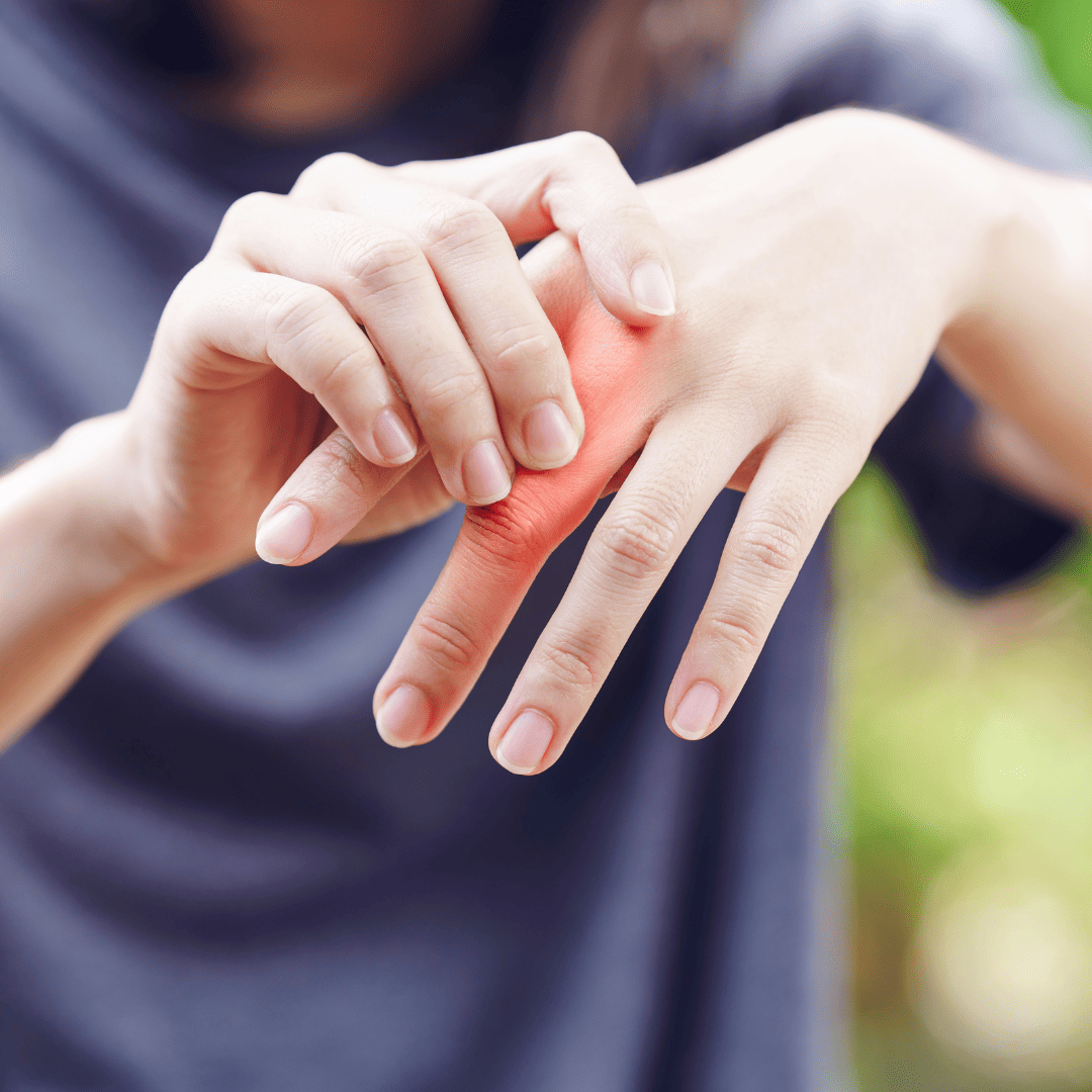 Enfermedades Musculoesqueléticas